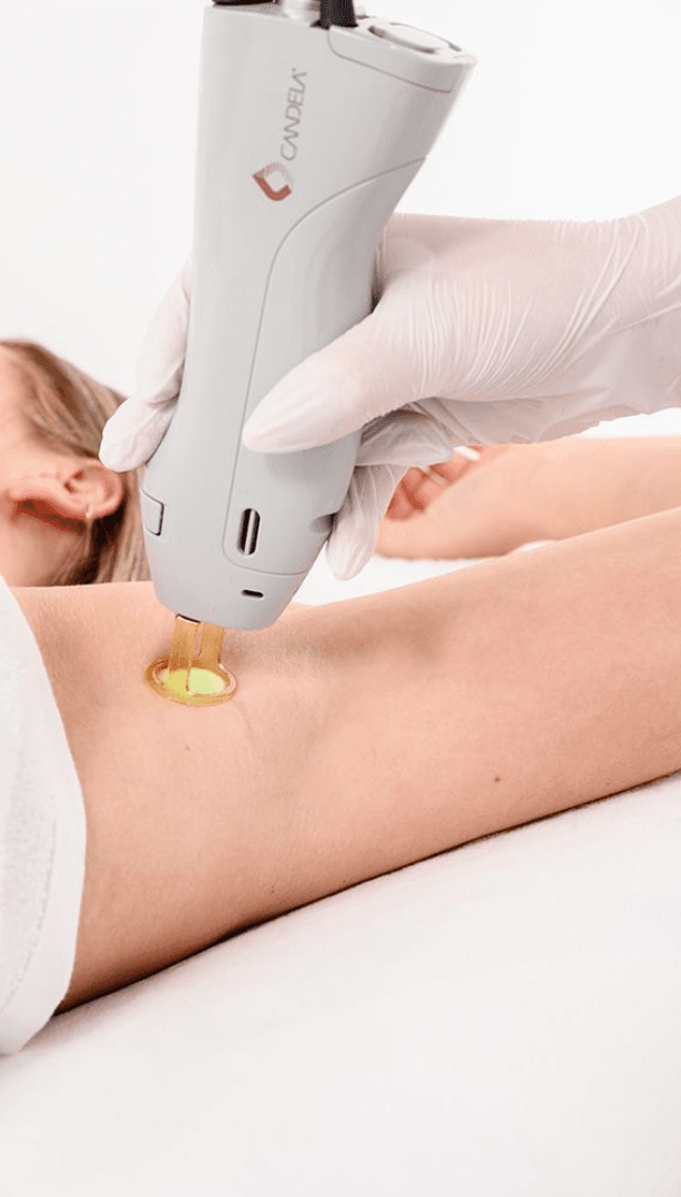 Doet laserontharing pijn? Het comfort van de GentleMax Pro Plus uitgelegd - 1