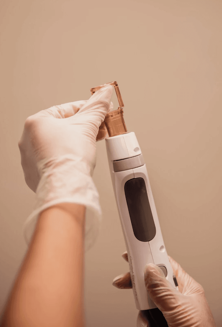 Laserontharing met de GentleMax Pro Plus: hoe werkt het en wat mag je verwachten? - 3